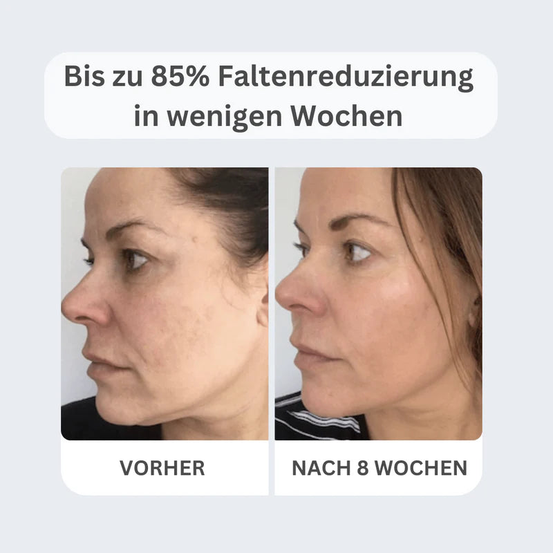 Anti-aging set I serum + lifting cream